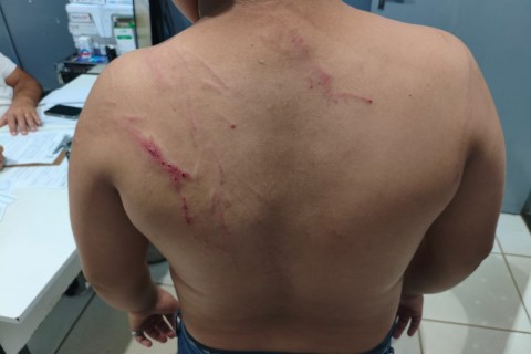 Idoso de 57 anos é preso em Uruaçu após espancar neto de 13 anos com pedaço de madeiraURUACU